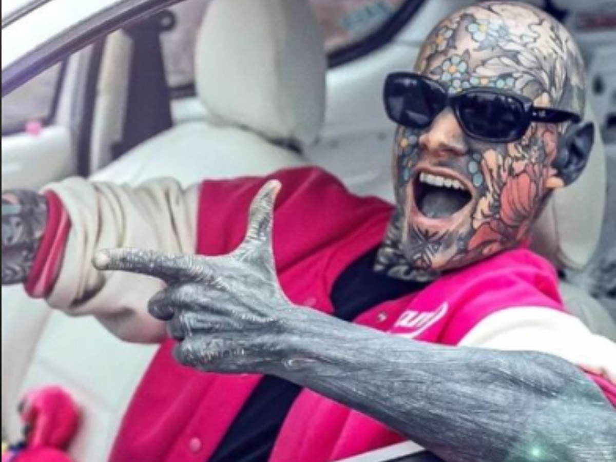 World's Most Tattooed Teacher Goes Under The Knife
